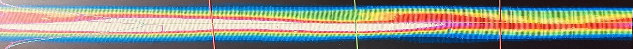 Abnormal/aged beam example